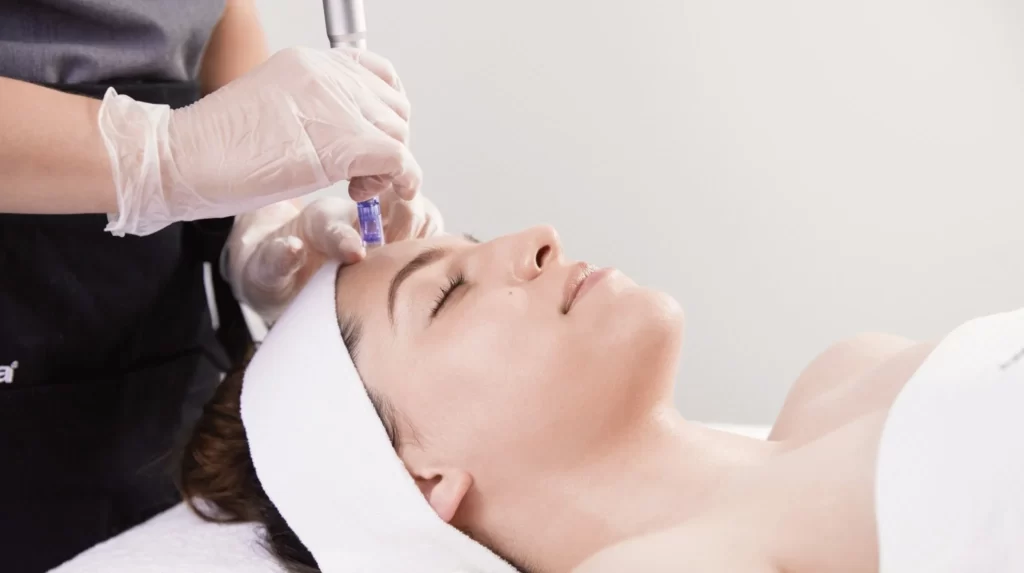 Best Microneedling skincare treatment services in Oakville